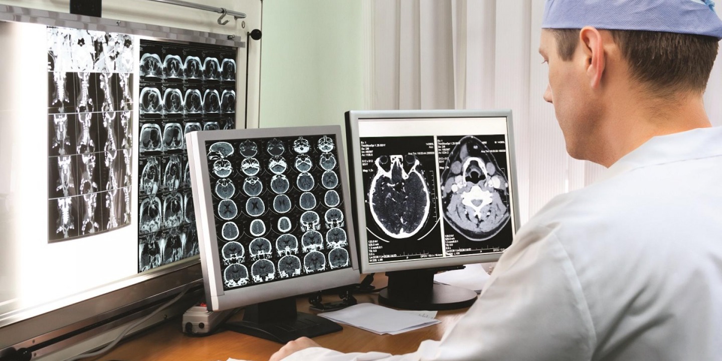 Brain Scans
