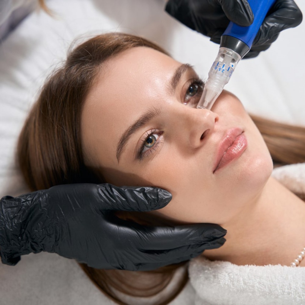 SkinPen Microneedling Facial | Innovations 25