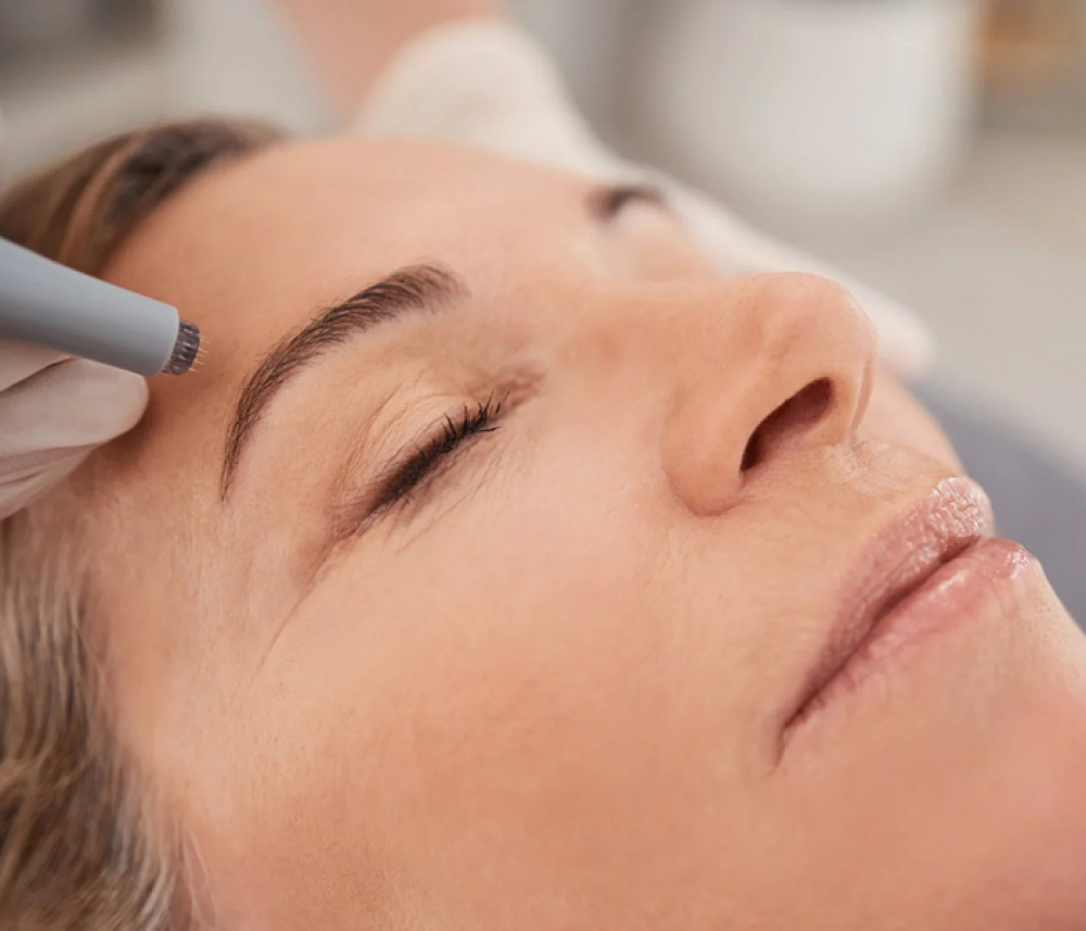 SkinPen & Red Light Treatment | The Skin & Wellness Clinic