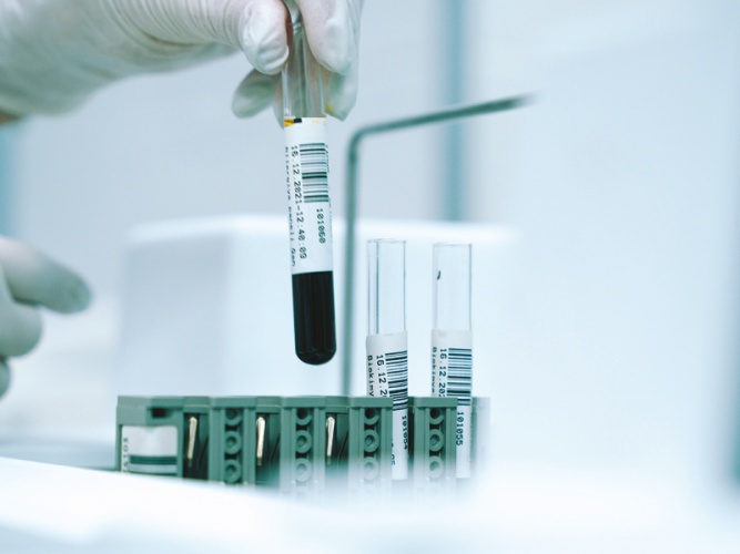 We Tried a Full Biomarker Body Analysis - Here's What We Thought