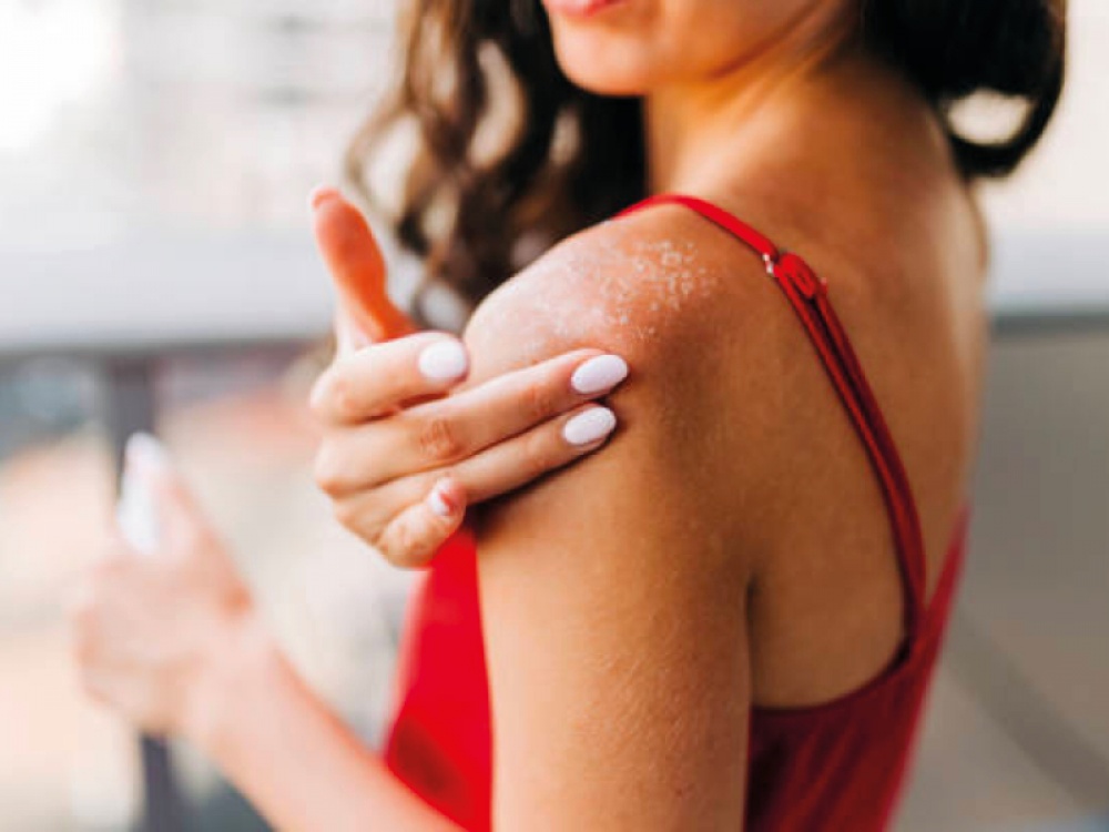 woman applying cream to her shoulder