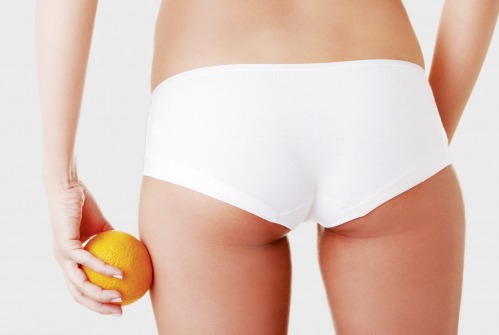 The Truth About Cellulite
