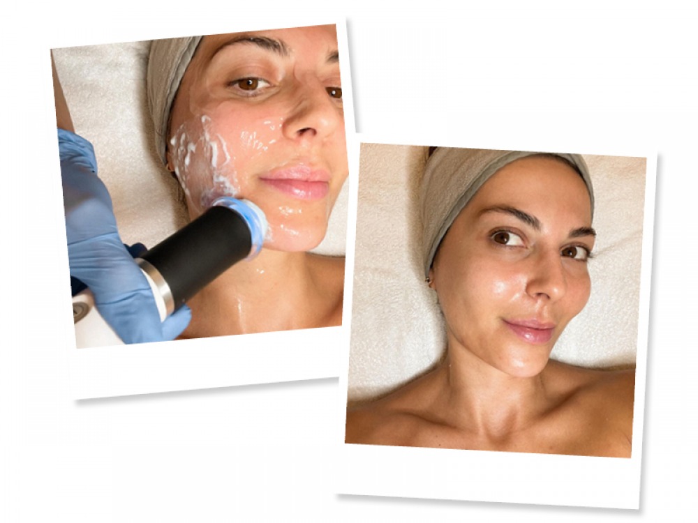 lady getting a facial
