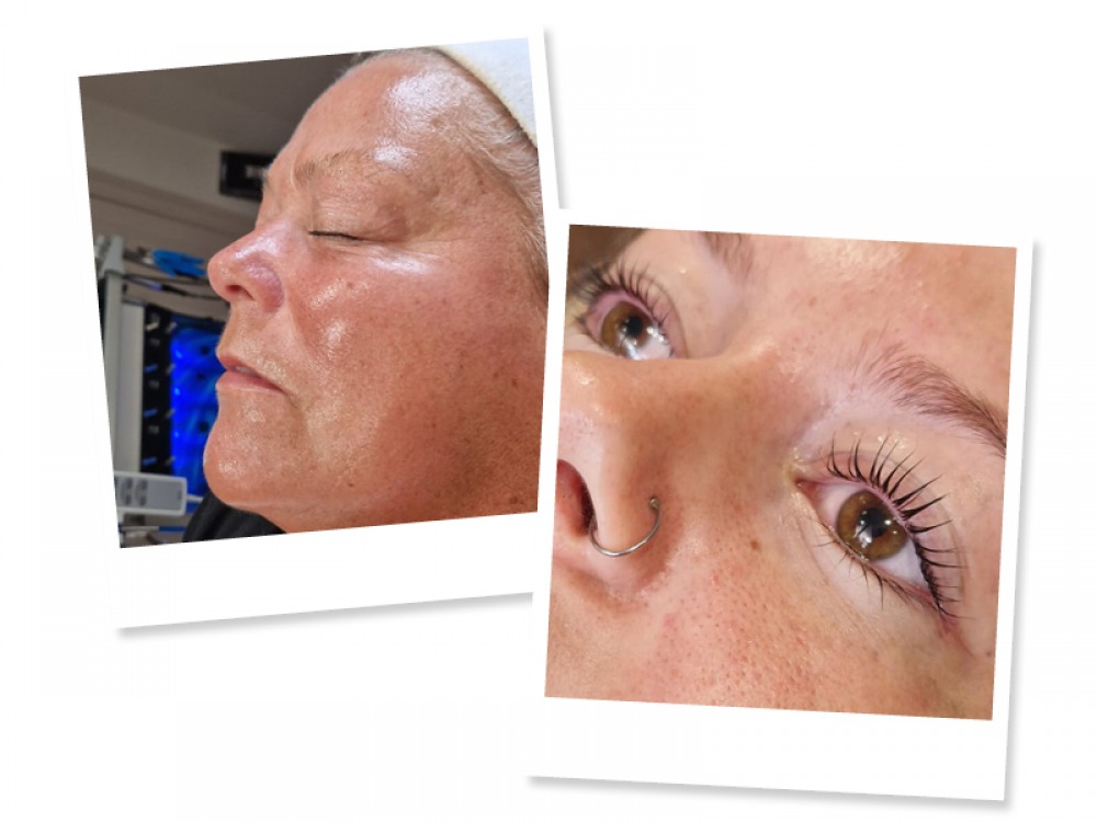 facial process