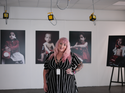 Meet the County Durham Photographer Shining a Spotlight on Down Syndrome, Organ Donations and Hair Loss